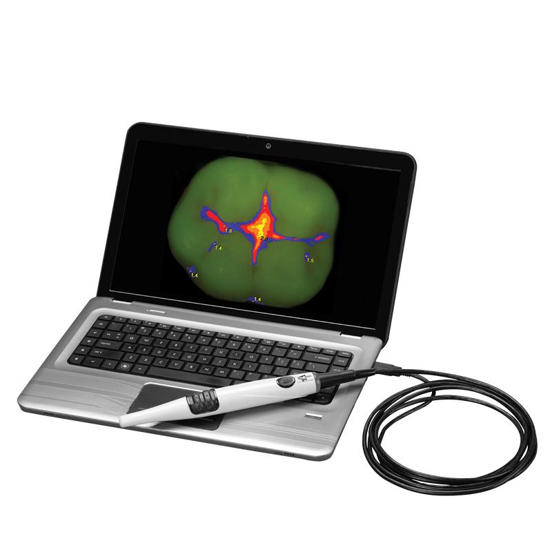 spectra_caries_detection_aid_2 Mt Eliza Dental Centre